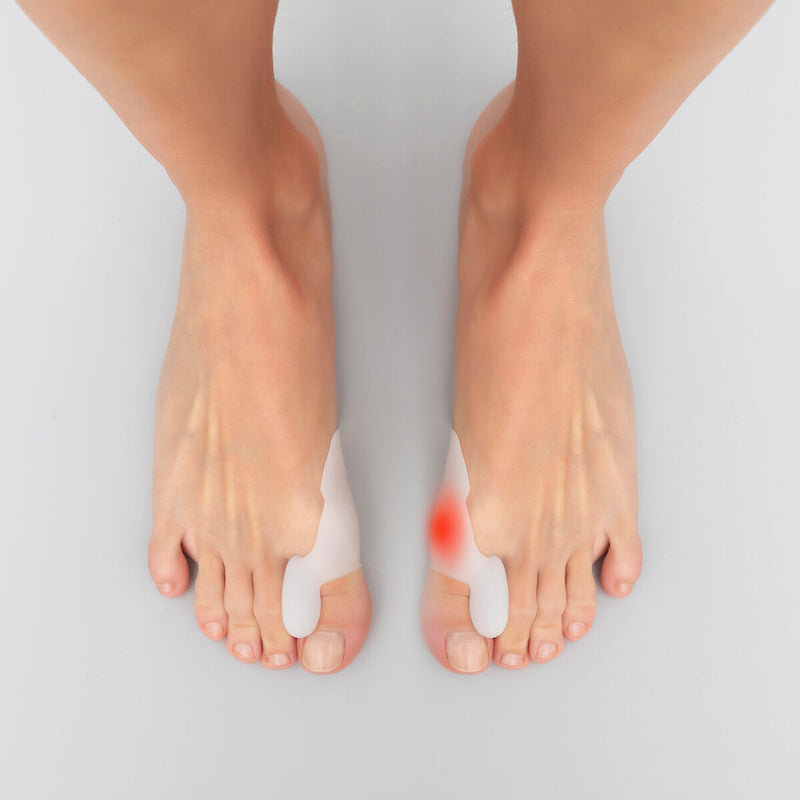 Pack Mellemfodspuder af gelé i silikone og Silikone Bunion Corrector Protector InnovaGoods